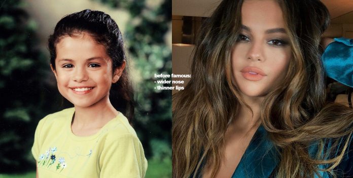 Selena Gomez Before Fame & Plastic Surgery vs After F