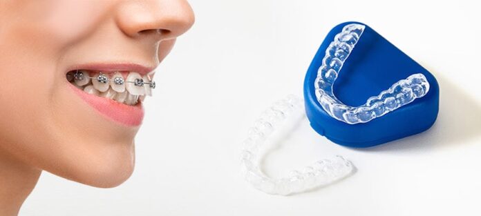 Understanding Modern Orthodontics