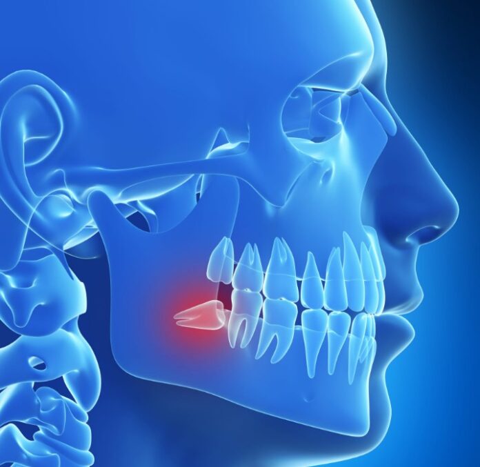 Basics of Dental Health